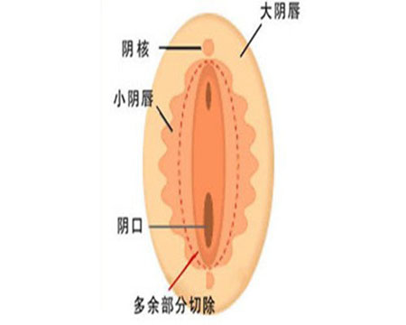 怎么刺激阴蒂快感最强