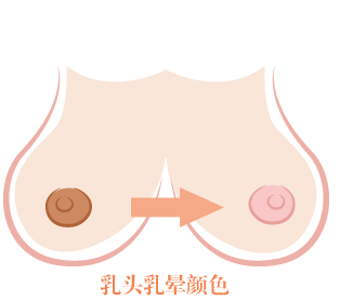 乳晕